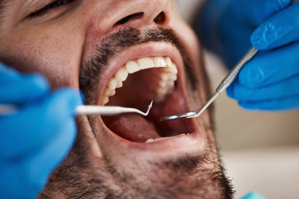 Best Affordable Emergency Dental Care  in Lubeck, WV